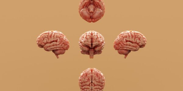 Photo Brain Implant